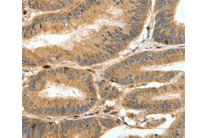Immunohistochemistry (IHC) image for anti-S100 Calcium Binding Protein A4 (S100A4) antibody (ABIN2426858) (s100a4 抗体)