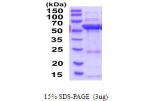 SDS-PAGE (SDS) image for 3-Hydroxy-3-Methylglutaryl-CoA Synthase 1 (Soluble) (HMGCS1) (AA 1-520) protein (His tag) (ABIN6387587) (HMGCS1 Protein (AA 1-520) (His tag))