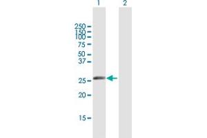 Western Blot analysis of IGKV1-5 expression in transfected 293T cell line by IGKV1-5 MaxPab polyclonal antibody. (IGKV1-5 抗体  (AA 1-235))