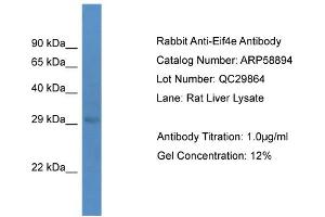 Western Blotting (WB) image for anti-Eukaryotic Translation Initiation Factor 4E (EIF4E) (C-Term) antibody (ABIN2787867) (EIF4E 抗体  (C-Term))