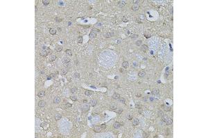 Immunohistochemistry of paraffin-embedded mouse brain using ACO1 antibody (ABIN1877037) (40x lens). (Aconitase 1 抗体)