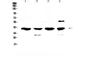 Western blot analysis of VEGFD using anti-VEGFD antibody . (VEGFD 抗体  (AA 89-205))
