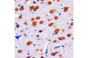Immunohistochemical analysis of DUSP16 staining in human brain formalin fixed paraffin embedded tissue section. (DUSP16 抗体  (C-Term))