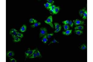 Immunofluorescence staining of HepG2 cells with ABIN7157950 at 1:166, counter-stained with DAPI. (LIME 抗体  (AA 170-295))