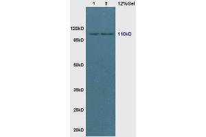 L1 rat brain lysates L2 rat colon lysates probed with Anti phospho-PI3KCA(TYR317) Polyclonal Antibody, Unconjugated (ABIN711521) at 1:200 in 4 °C. (PIK3CA 抗体  (pTyr317))