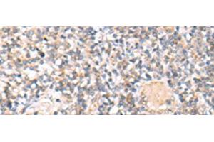 Immunohistochemistry of paraffin-embedded Human tonsil tissue using IL36A Polyclonal Antibody at dilution of 1:30(x200) (IL36A/IL1F6 抗体)