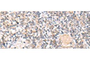 Immunohistochemistry of paraffin-embedded Human tonsil tissue using IL36A Polyclonal Antibody at dilution of 1:30(x200) (IL36A/IL1F6 抗体)