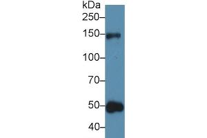 Western blot analysis of Human Urine, using Rat THBS1 Antibody (5 µg/ml) and HRP-conjugated Goat Anti-Rabbit antibody ( (Thrombospondin 1 抗体  (AA 71-259))