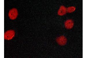 ABIN6269080 staining MCF-7 cells by ICC/IF. (Estrogen Receptor alpha 抗体  (C-Term))