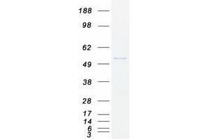 Western Blotting (WB) image for Epoxide Hydrolase 1, Microsomal (Xenobiotic) (EPHX1) (Transcript Variant 1) protein (Myc-DYKDDDDK Tag) (ABIN2720323)