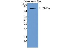Detection of Recombinant NOTCH3, Human using Polyclonal Antibody to Notch Homolog 3 (NOTCH3) (NOTCH3 抗体  (AA 2053-2318))