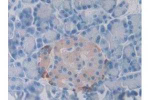 DAB staining on IHC-P; Samples: Rat Pancreas Tissue (SLIT1 抗体  (AA 611-791))