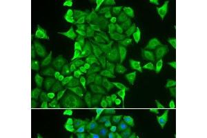 Immunofluorescence analysis of HeLa cells using CARS Polyclonal Antibody (CARS 抗体)