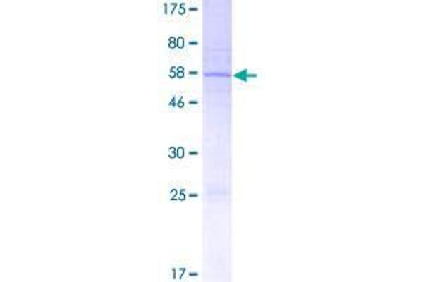 C19ORF80 Protein (GST tag)