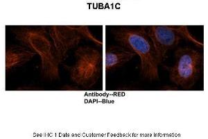Sample Type: Human brain stem cells Primary Antibody Dilution: 1:500Secondary Antibody: Goat anti-rabbit Alexa-Fluor 594 Secondary Antibody Dilution: 1:0000Color/Signal Descriptions: TUBA1C: Red DAPI: Blue  Gene Name: TUBA1C Submitted by: Dr. (TUBA1C 抗体  (C-Term))