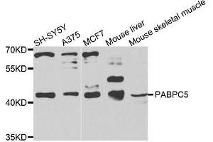 Western blot analysis of extracts of various cell lines, using PABPC5 antibody (ABIN6003706) at 1/1000 dilution. (PABPC5 抗体)