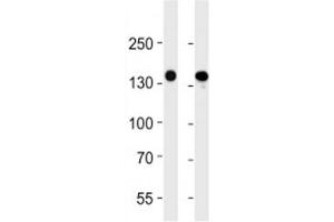 VEGFR3 antibody western blot analysis in 293 and A549 lysate. (FLT4 抗体)