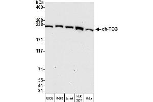 anti-Cytoskeleton Associated Protein 5 (CKAP5) (AA 1425-1475) antibody