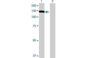 Western Blot analysis of UTP14A expression in transfected 293T cell line by UTP14A MaxPab polyclonal antibody. (UTP14A 抗体  (AA 1-771))