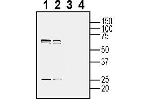 Western blot analysis of mouse  microglia cell line lysate (lanes 1 and 3) and mouse P815 mastocytoma cell line lysate (lanes 2 and 4):1-2. (Tetraspanin 2 抗体  (Extracellular))