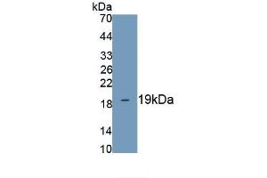 Detection of Recombinant LPCAT3, Mouse using Polyclonal Antibody to Lysophosphatidylcholine Acyltransferase 3 (LPCAT3) (LPCAT3 抗体)