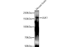 Western blot analysis of extracts of Mouse brain, using ULK1 antibody (ABIN6134005, ABIN6149921, ABIN6149922 and ABIN6224624) at 1:1000 dilution. (ULK1 抗体  (AA 400-499))