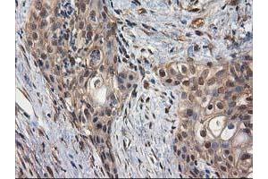 Image no. 3 for anti-Destrin (Actin Depolymerizing Factor) (DSTN) antibody (ABIN1497910) (Destrin 抗体)