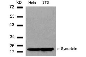 Image no. 2 for anti-Synuclein, alpha (SNCA) (Tyr136) antibody (ABIN319339) (SNCA 抗体  (Tyr136))