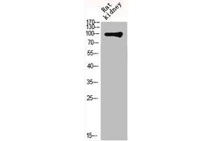 Western Blot analysis of RAT-KIDNEY cells using mGluR-4 Polyclonal Antibody (Metabotropic Glutamate Receptor 4 抗体  (C-Term))