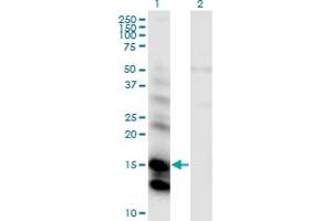 Western Blot analysis of CST6 expression in transfected 293T cell line by CST6 monoclonal antibody (M01), clone 2H8. (CST6 抗体  (AA 29-149))