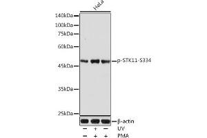 Western blot analysis of extracts of HeLa cells, using Phospho-STK11-S334 antibody (ABIN6135322, ABIN6136260, ABIN6136261 and ABIN6225618) at 1:1000 dilution. (LKB1 抗体  (pSer334))