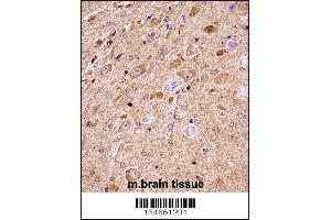 Mouse Nlk Antibody immunohistochemistry analysis in formalin fixed and paraffin embedded mouse brain tissue followed by peroxidase conjugation of the secondary antibody and DAB staining. (Nemo-Like Kinase 抗体  (C-Term))