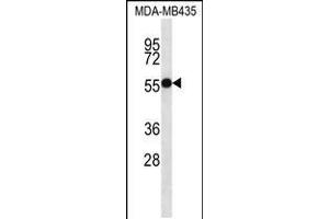 Western blot analysis in MDA-MB435 cell line lysates (35ug/lane). (ASB4 抗体  (C-Term))