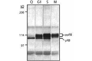 Cell cycle expression of retinoblastoma proteins (Rb) in MOLT-4 human leukemia cell line expressing Rb. (Retinoblastoma 1 抗体  (AA 332-344))