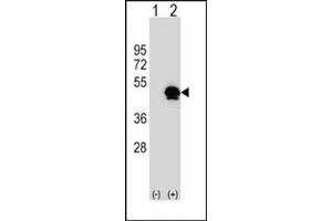 Western blot analysis of SERPINE1 (arrow) using SERPINE1 Antibody (Center) Cat. (PAI1 抗体  (Middle Region))
