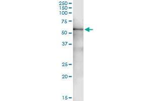 Immunoprecipitation of RP6-213H19. (STK26/MST4 抗体  (AA 1-416))