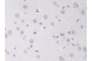 Detection of GDNF in Rat Cerebrum Tissue using Polyclonal Antibody to Glial Cell Line Derived Neurotrophic Factor (GDNF) (GDNF 抗体  (AA 78-211))