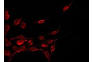 ABIN6275044 staining A549 by IF/ICC. (CST11 抗体  (Internal Region))