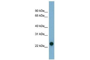 AK3 antibody used at 1 ug/ml to detect target protein. (Adenylate Kinase 3 抗体  (N-Term))