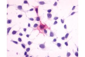 Anti-MC4 Receptor antibody immunocytochemistry (ICC) staining of HEK293 human embryonic kidney cells transfected with MC4 Receptor. (MC4R 抗体  (N-Term))