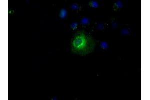 Image no. 11 for anti-Protein Phosphatase 5, Catalytic Subunit (PPP5C) antibody (ABIN1500389)