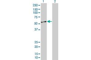 Western Blotting (WB) image for ENO2 293T Cell Transient Overexpression Lysate(Denatured) (ABIN1331707)