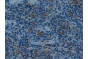 Detection of ACP5 in Rat Spleen Tissue using Polyclonal Antibody to Acid Phosphatase 5, Tartrate Resistant (ACP5) (ACP5 抗体  (AA 29-296))
