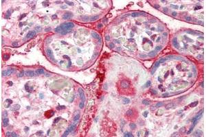 Human Placenta (formalin-fixed, paraffin-embedded) stained with CENTA2 antibody ABIN337009 at 5 ug/ml followed by biotinylated anti-goat IgG secondary antibody ABIN481715, alkaline phosphatase-streptavidin and chromogen. (ADAP2 抗体  (AA 375-387))
