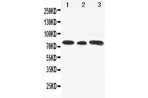 Anti-Gli3 antibody, Western blotting Lane 1: Rat Testis Tissue Lysate Lane 2: A549 Cell Lysate Lane 3: SW620 Cell Lysate (GLI3 抗体  (N-Term))