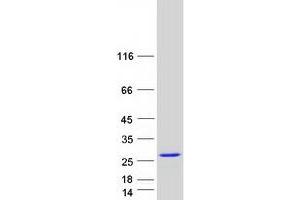Western Blotting (WB) image for Calcium Binding Protein P22 (CHP) protein (Myc-DYKDDDDK Tag) (ABIN2713041)