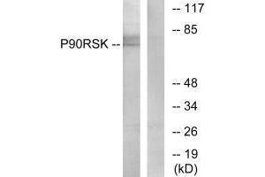 Western blot analysis of extracts from 3T3 cells, treated with PMA (125 ng/mL, 30 mins), using p90 RSK (Ab-573) antibody. (RPS6KA1 抗体  (Thr573))