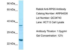 Western Blotting (WB) image for anti-Ribosomal Protein S5 (RPS5) (C-Term) antibody (ABIN2789701) (RPS5 抗体  (C-Term))