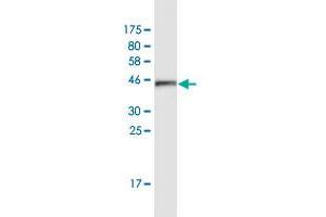 Western Blot detection against Immunogen (42. (ATXN7L1 抗体  (AA 1-146))