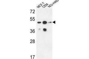 Western Blotting (WB) image for anti-Sphingomyelin Synthase 2 (SGMS2) antibody (ABIN3004329) (Sphingomyelin Synthase 2 抗体)